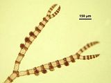 4 - Porzione apicale con tetrasporocisti